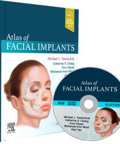 Atlas of Facial Implants (2nd Edition)