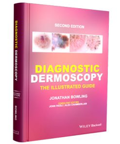 Diagnostic Dermoscopy: The Illustrated Guide (2nd Edition)