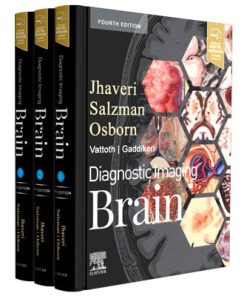 Diagnostic Imaging: Brain (4th Edition) 2021
