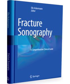 Fracture Sonography A Comprehensive Clinical Guide