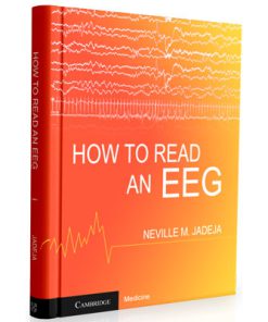 How to Read an EEG (1st Edition)