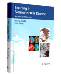Imaging in Neurovascular Disease A Case-Based Approach-2020