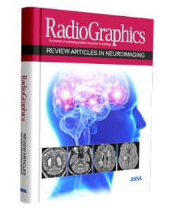 Radiographics (Review Articles Neuroimaging)
