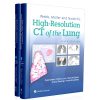 Webb, Müller and Naidich's High-Resolution CT of the Lung (6th Edition)