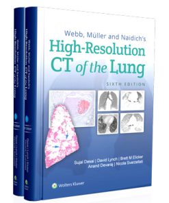 Webb, Müller and Naidich's High-Resolution CT of the Lung (6th Edition)