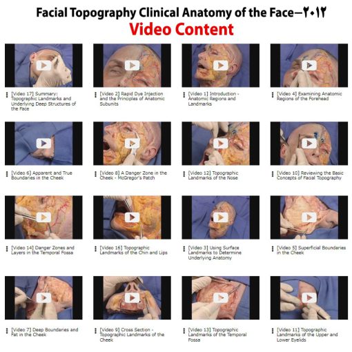 Facial Topography: Clinical Anatomy of the Face