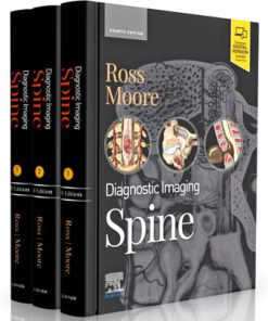 Diagnostic Imaging: Spine (4th Edition)