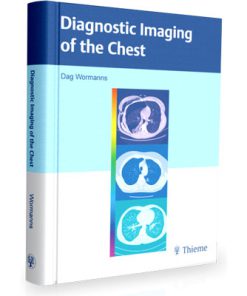 Diagnostic Imaging of the Chest