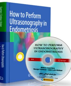How to Perform Ultrasonography in Endometriosis (1st Edition)