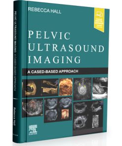 Pelvic Ultrasound Imaging A Cased-Based Approach (1st Edition)