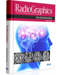 Radiographics: Neuroimaging