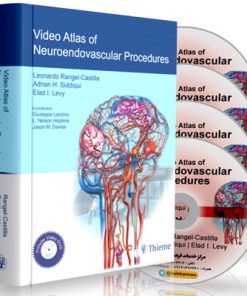 Video Atlas of Neuroendovascular Procedures (1st Edition)