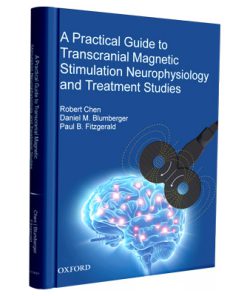 A Practical Guide to Transcranial Magnetic Stimulation Neurophysiology