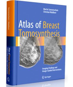 Atlas of Breast Tomosynthesis - Imaging Findings and Image-Guided Interventions