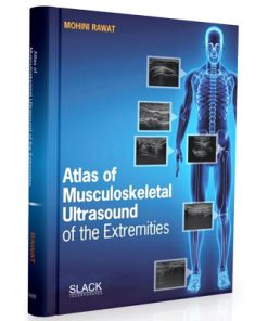 Atlas of Musculoskeletal Ultrasound of the Extremities