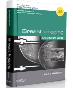 Case Review Series - Breast Imaging