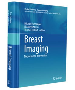 Breast Imaging: Diagnosis and Intervention