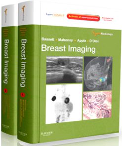Expert Radiology Series - Breast Imaging