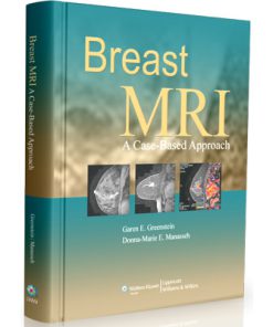 Breast MRI - A Case-Based Approach