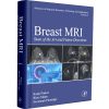Breast MRI - State of the Art and Future Directions