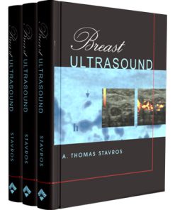 Breast Ultrasound - Stavros