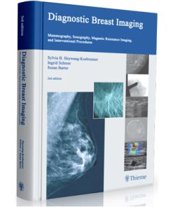 Diagnostic Breast Imaging - Mammography, Sonography, MRI and Interventional Procedures