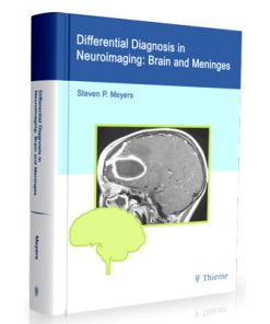 Differential Diagnosis in Neuroimaging - Brain and Meninges