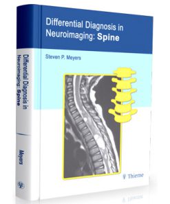 Differential Diagnosis in Neuroimaging - Spine