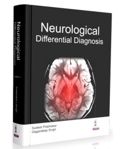 Differential Diagnosis in Neurology