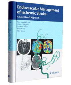 Endovascular Management of Ischemic Stroke: A Case-Based Approach