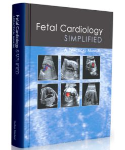 Fetal Cardiology Simplified - A Practical Manual