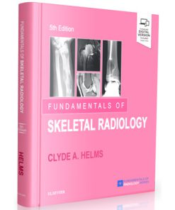Fundamentals of Skeletal Radiology