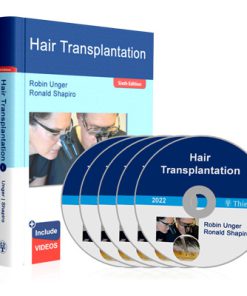 Hair Transplantation Shapiro (6th Edition)
