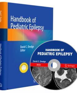 Handbook of Pediatric Epilepsy