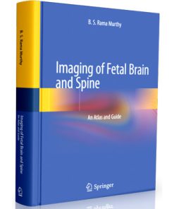 Imaging of Fetal Brain and Spine - An Atlas and Guide