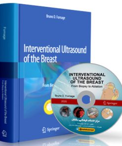 Interventional Ultrasound of the Breast - From Biopsy to Ablation