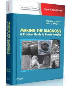 Making the Diagnosis - A Practical Guide to Breast Imaging (Expert Consult)