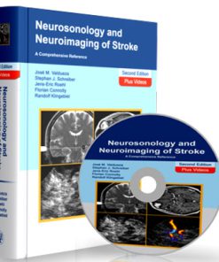 Neurosonology and Neuroimaging of Stroke - A Comprehensive Reference