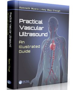 Practical Vascular Ultrasound An Illustrated Guide