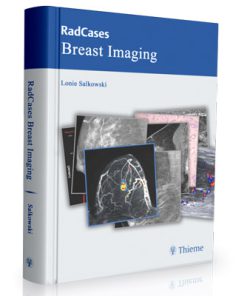 Radcases Breast Imaging (Radcases Plus Q&A) 1st Edition