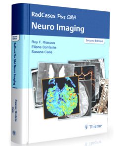 RadCases Plus Q&A Neuro Imaging 2nd Edition