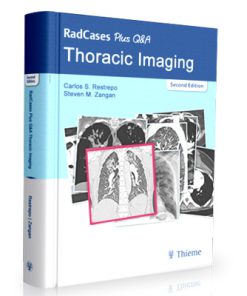 RadCases Thoracic Imaging (2nd Edition)