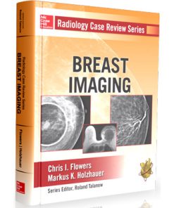 Radiology Case Review Series - Breast Imaging