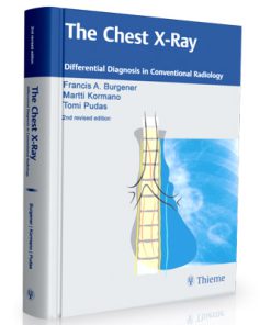 The Chest X-Ray - Differential Diagnosis in Conventional Radiology