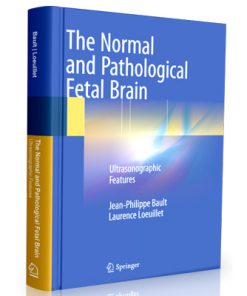 The Normal and Pathological Fetal Brain - Ultrasonographic Features