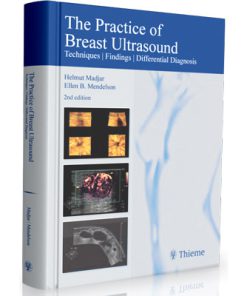 The Practice of Breast Ultrasound - Techniques, Findings, Differential Diagnosis