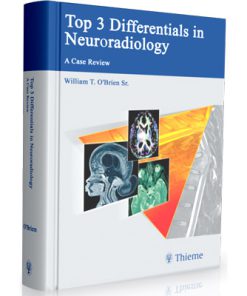 Top 3 Differentials in Neuroradiology: A Case Review
