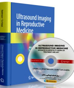 Ultrasound Imaging in Reproductive Medicine: Advances in Infertility Work-up, Treatment and ART