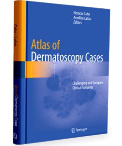 Atlas of Dermatoscopy Cases: Challenging and Complex Clinical Scenarios