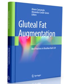 Gluteal Fat Augmentation: Best Practices in Brazilian Butt Lift